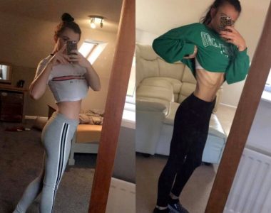 Woman battling anorexia says girls' trip saved her life
