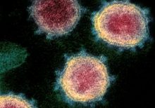 'SARS-like damage' seen in dead coronavirus patient in China, report says