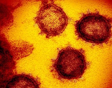 Florida reports 2 dead from coronavirus, first known fatalities on East Coast