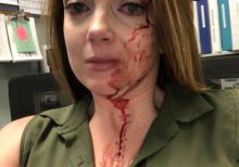 California retail employee posts photo of her bloody face after alleged customer attack
